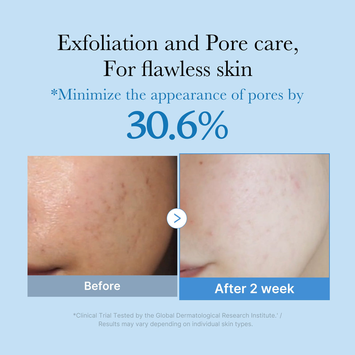 zero-pore-toner-b3 01_d6480b4e-3c08-4954-994a-ed5212c1839c.jpg