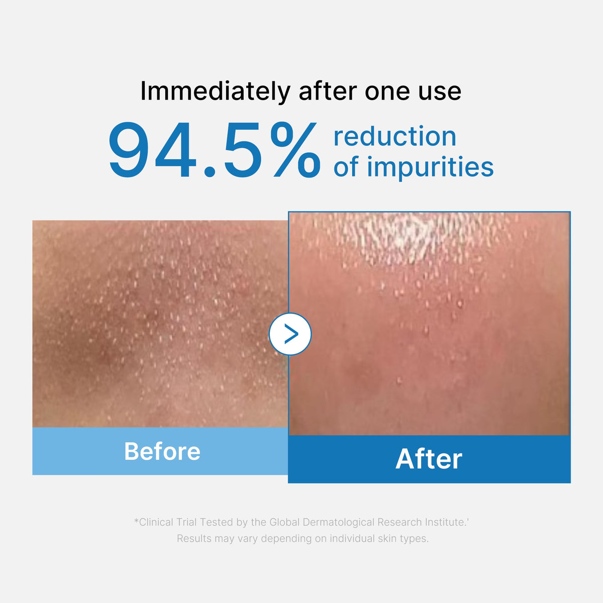 zero-pore-blackhead-deep-cleansing-oil-c0 01_eed557ec-5857-46a2-8b17-dbd67c692dcb.jpg