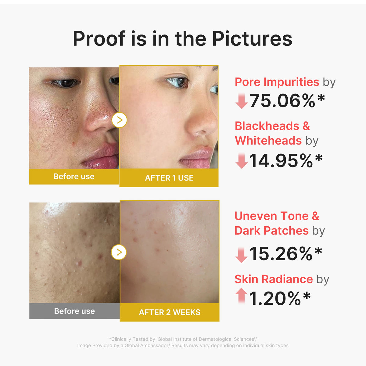 kojic-acid-turmeric-peel-shot-s6 02_45fe66d3-b3f6-4100-aa52-2afd7eded417.jpg