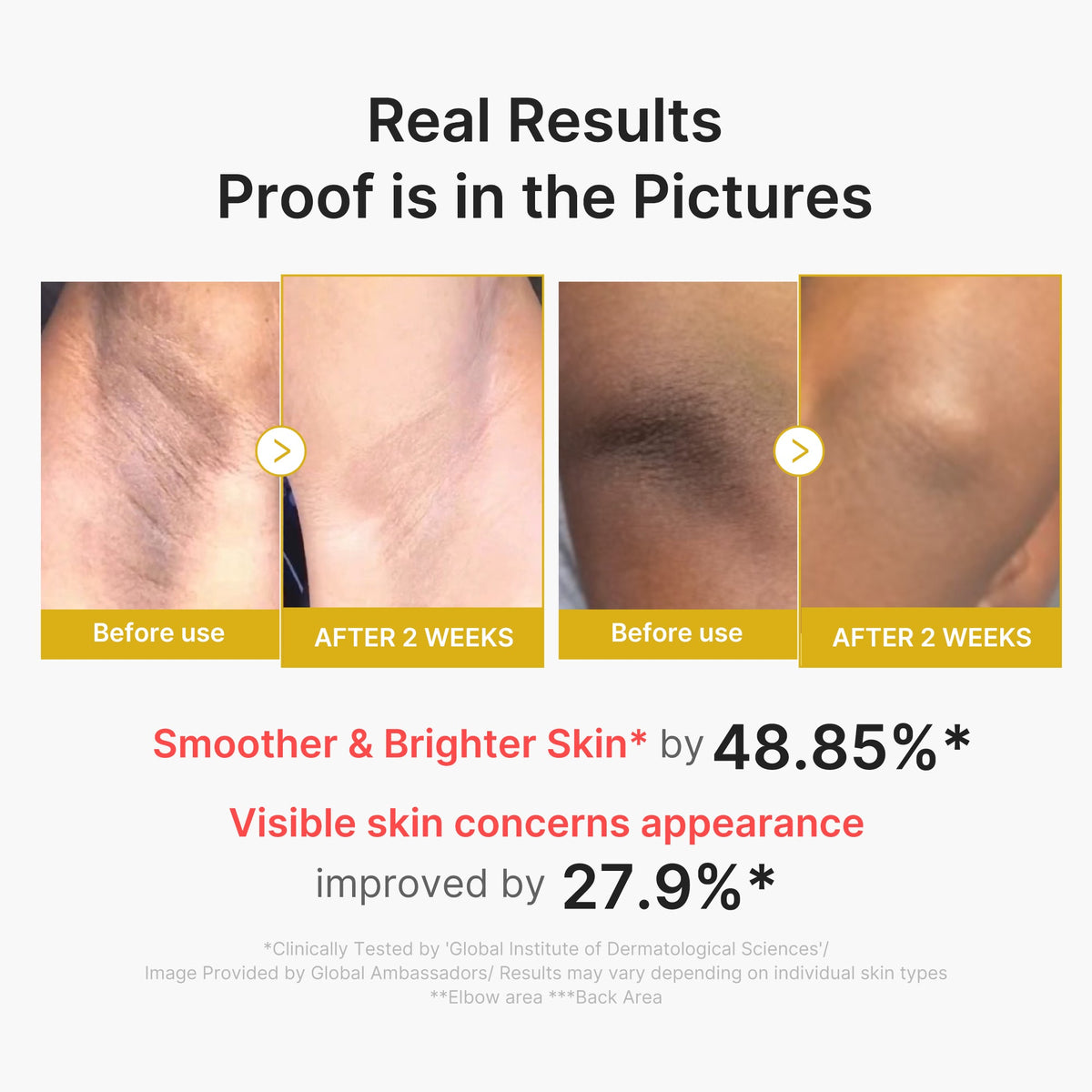 kojic-acid-turmeric-body-peel-shot-n2 02_72880cfc-382b-440b-8152-7e3dce87da2a.jpg