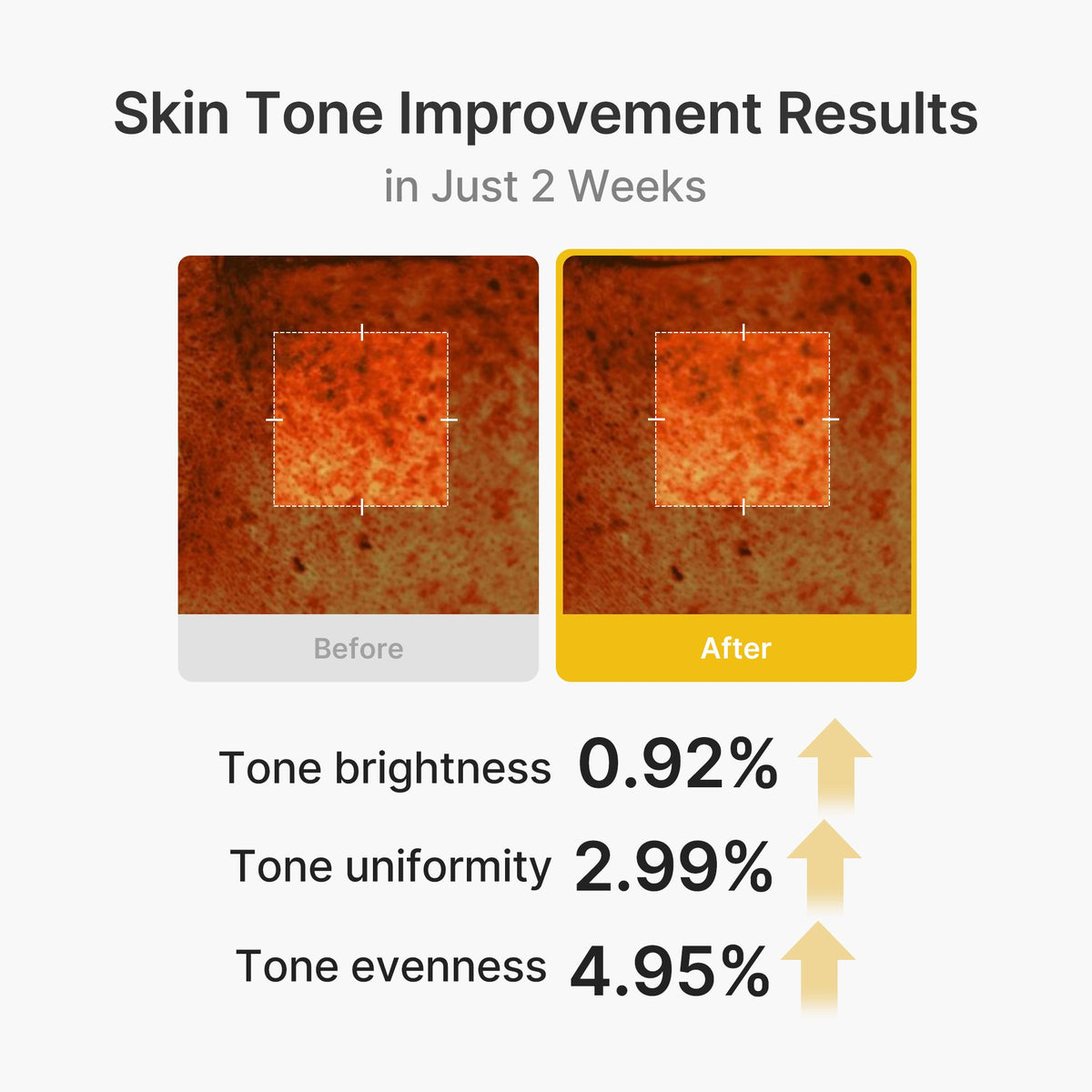 kojic-acid-turmeric-vita-capsule-cream-b4 03_2b626701-fc6c-4702-9e96-a2157a4f7f9d.jpg