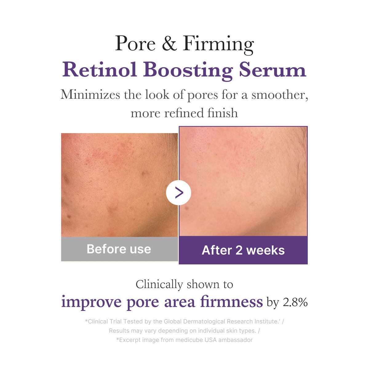 retinol-nmn-boosting-serum-q3 03_3510e7a5-5633-4a18-81ea-1389593bd517.jpg