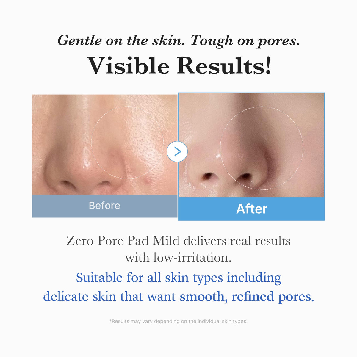 zero-pore-madecassoside-pads-mild-h0 04_6357f9f9-483b-4891-82c6-a58d336e62c8.jpg