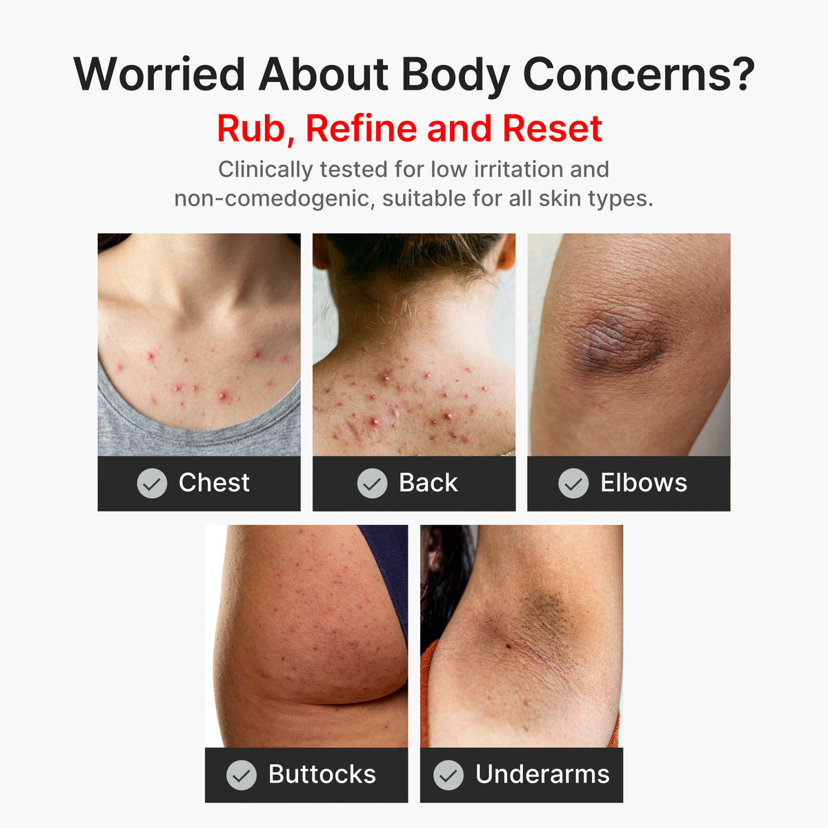 kojic-acid-turmeric-body-peel-shot-n2 04_8a7237f2-3ebf-401e-bd85-54841aeb3efc.jpg