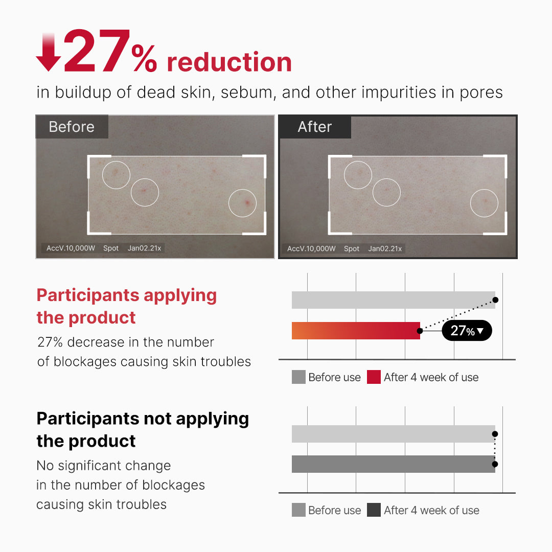 red-body-peeling-shot-cleanser-g3 07_60b5b2fd-b0f0-4cae-b358-5c38181e8dd8.jpg