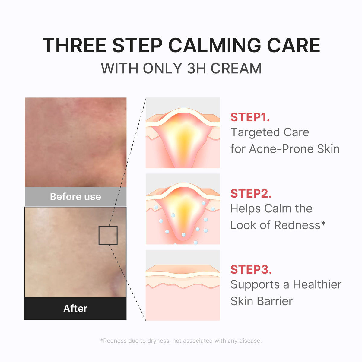 3h-daily-relief-cream-k0 3H_04.jpg