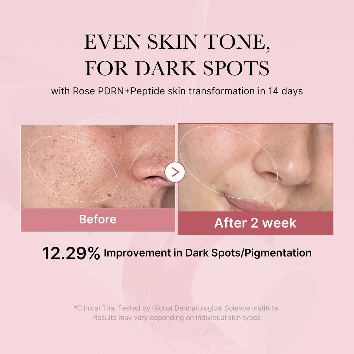 pdrn-pink-peptide-toner-n6 PDRN_01_308c518e-5ac6-4e54-99bd-eabc8796739b.jpg