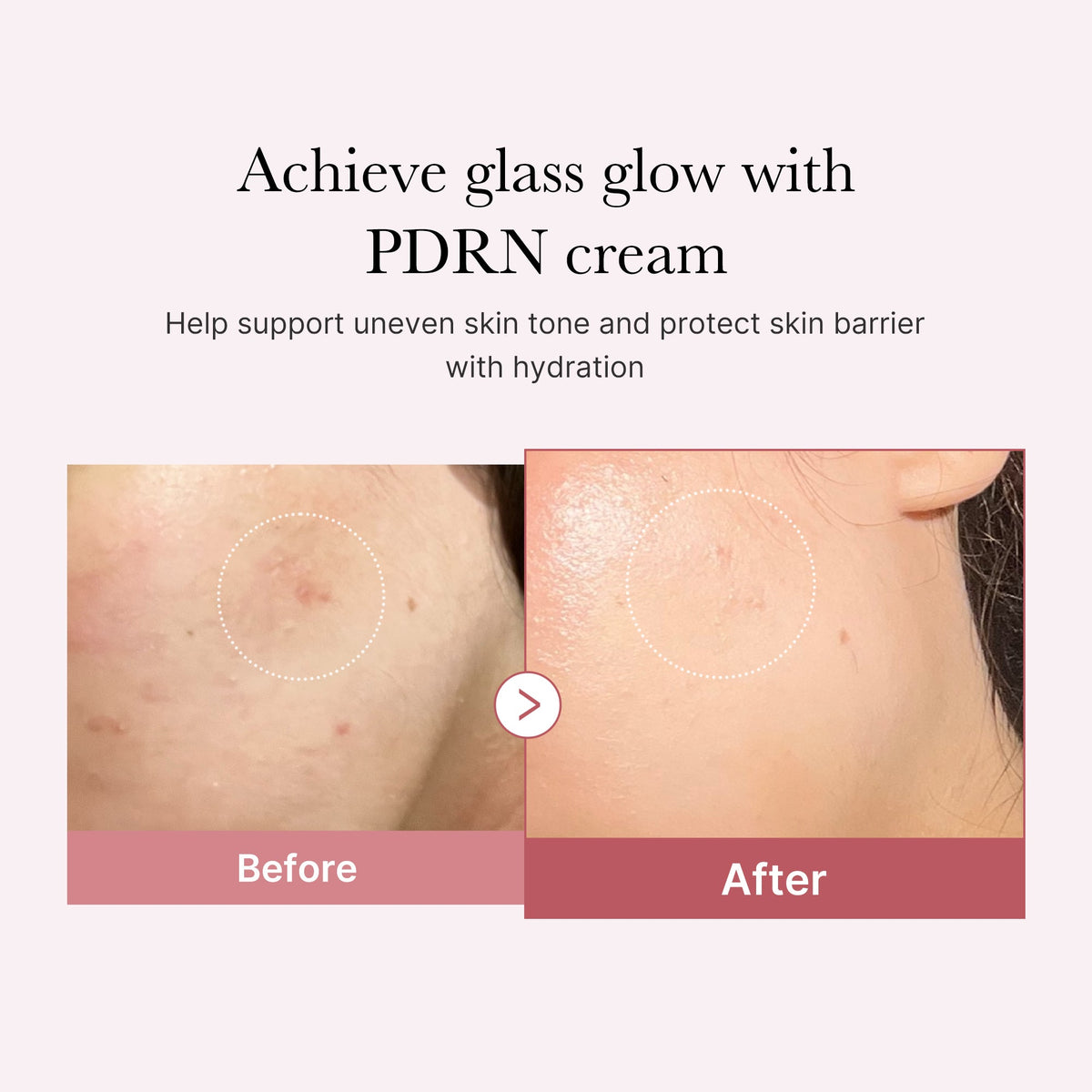 pdrn-pink-peptide-cream-s5 PDRN_02_d7805bfe-cf43-446a-b71b-a276683f136b.jpg