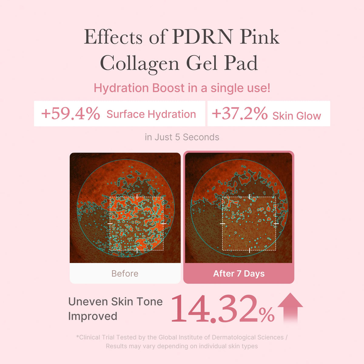 pdrn-pink-collagen-gel-toner-pad-q2 PDRN_04_f9a16a56-8d9e-4c47-a635-ed34ec3ed571.jpg
